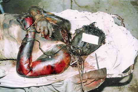 Figure 6: Another view of the dead body after hands were opened.